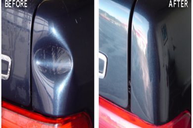 Dent Removal